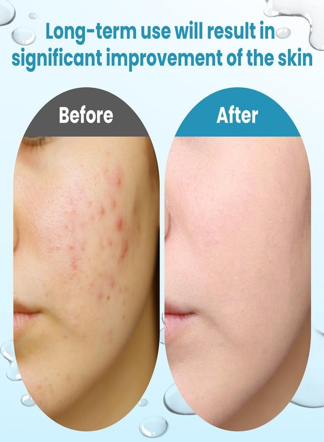 دالين ضمادات تقشير البشرة بحمض الجليكوليك، تحتوي على 15% من حمض الجليكوليك فائق النقاء و2% من حمض الساليسيليك، لتقشير البشرة والحفاظ على نعومتها ومنع ظهور التجاعيد والخطوط الدقيقة، لتجديد البشرة وإضفاء النضارة عليها - 60 ضمادة - Image 4